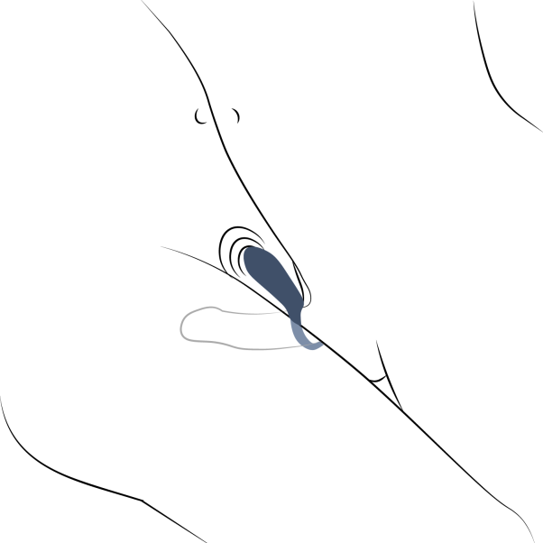 Amaysin Wiederaufladbarer Penisring mit Vibration